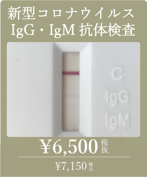 新型コロナウイルス 抗体検査